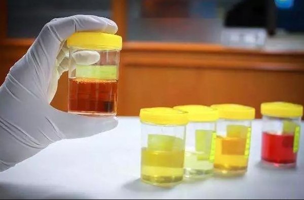 尼替西农Harliku获FDA批准用于AKU